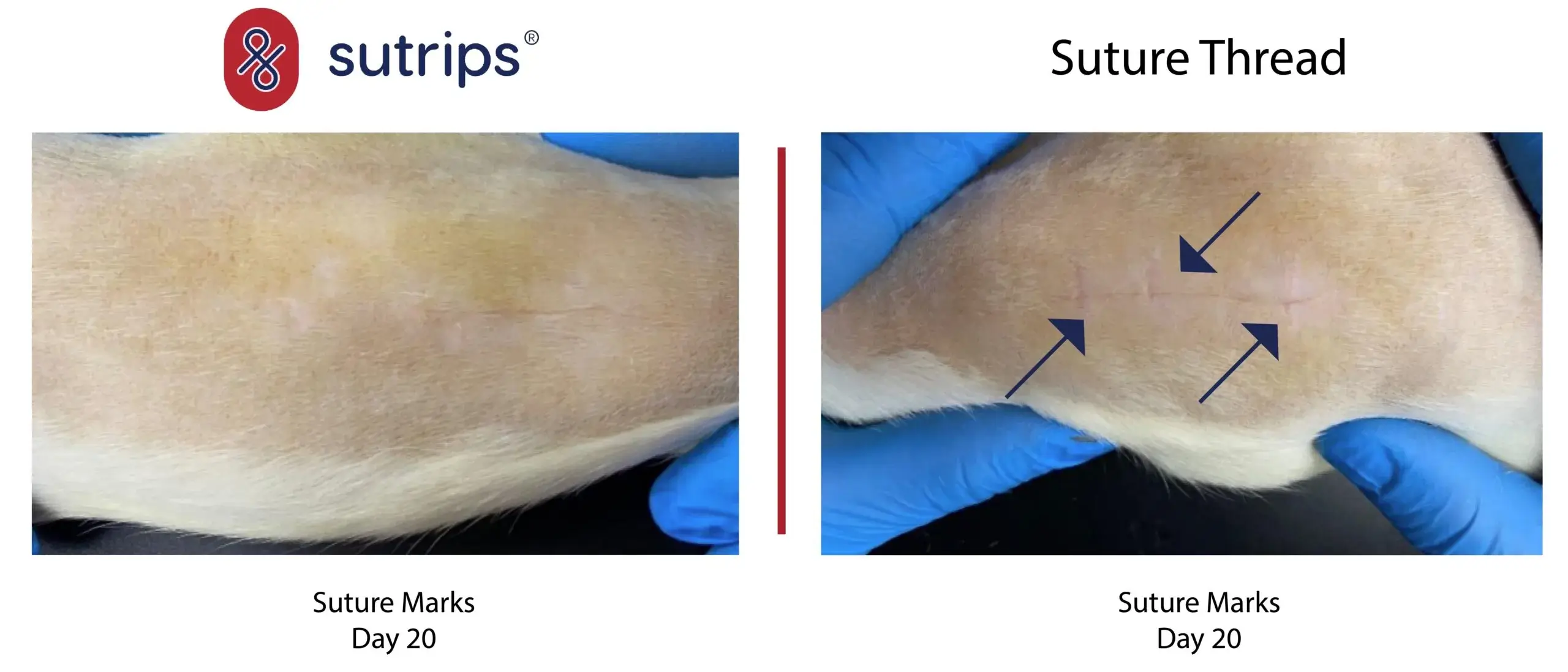 Suture Marks